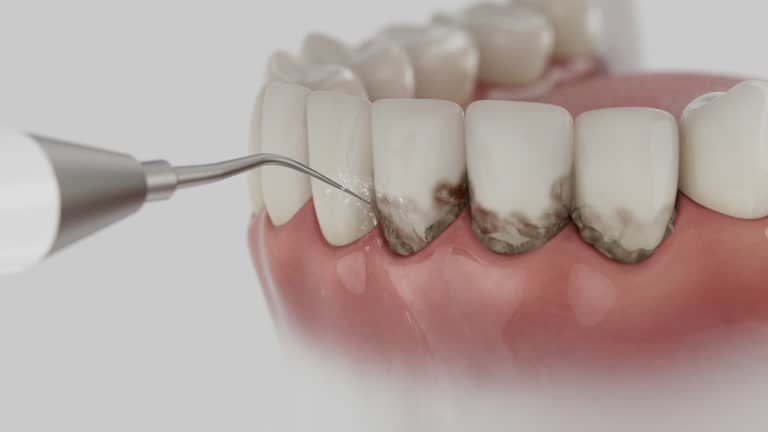 Trusted Teeth Cleaning And Checkup service in Yulee, FL - Dentist Open Now